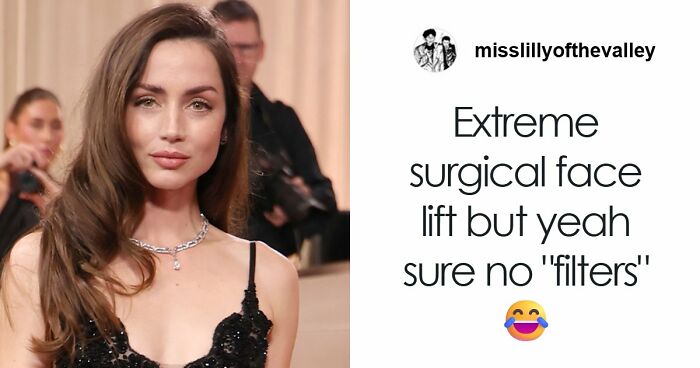 “This Is Not Filler. This Is Not Botox”: Facialist Spill Secret Behind Lifted Celeb Look At 83rd Golden Globes