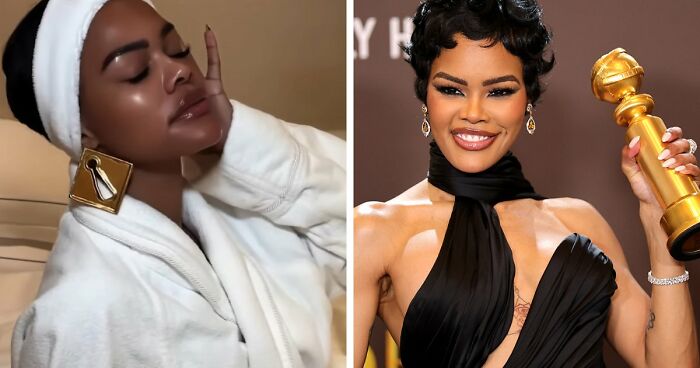 “This Is Not Filler, This Is Not Botox”: Celeb Facialist Reveals Secrets Behind Golden Globes Glow