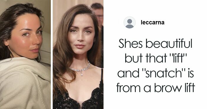 “This Is Not Filler, This Is Not Botox”: Celeb Facialist Reveals Secrets Behind Golden Globes Glow