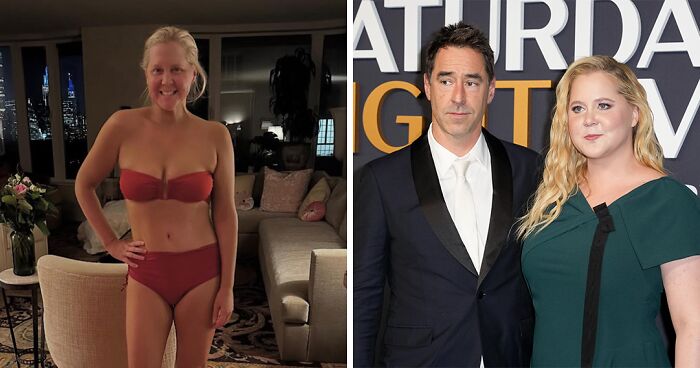 57 Fascinating And Unnerving Medical Photos Not Everyone Can Handle (New Pics)