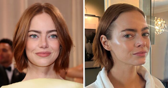 “Like A Plastic Robot”: Facialist Reveals What Celebrities Actually Did Before The Golden Globes