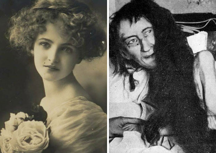 Vintage photo of a woman alongside a disturbing historical image, illustrating unsettling true crime stories of vanished people.