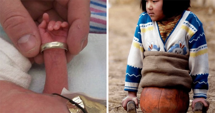 57 Fascinating And Unnerving Medical Photos Not Everyone Can Handle (New Pics)