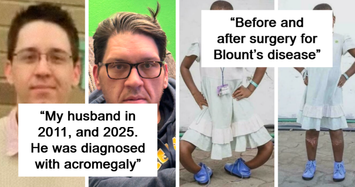 57 Fascinating And Unnerving Medical Photos Not Everyone Can Handle (New Pics)