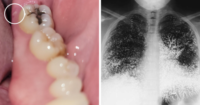 57 Fascinating And Unnerving Medical Photos Not Everyone Can Handle (New Pics)