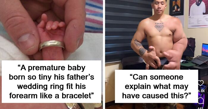 57 Fascinating And Unnerving Medical Pics You May Need A Minute To Process (New Pics)