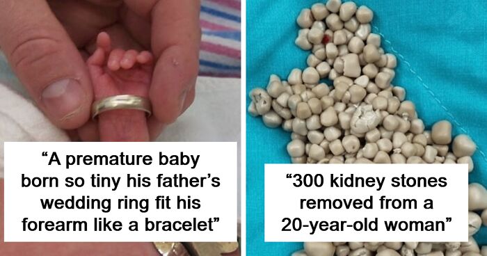 57 Fascinating And Unnerving Medical Pics You May Need A Minute To Process (New Pics)