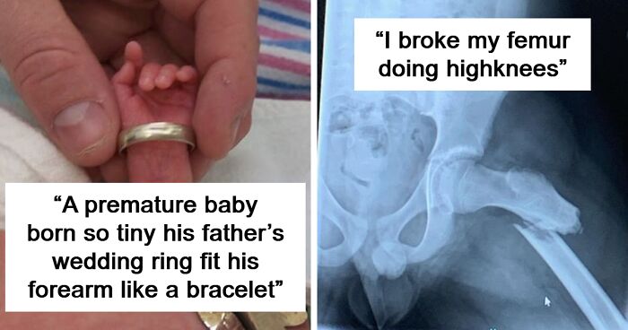 57 Fascinating And Unnerving Medical Pics You May Need A Minute To Process (New Pics)