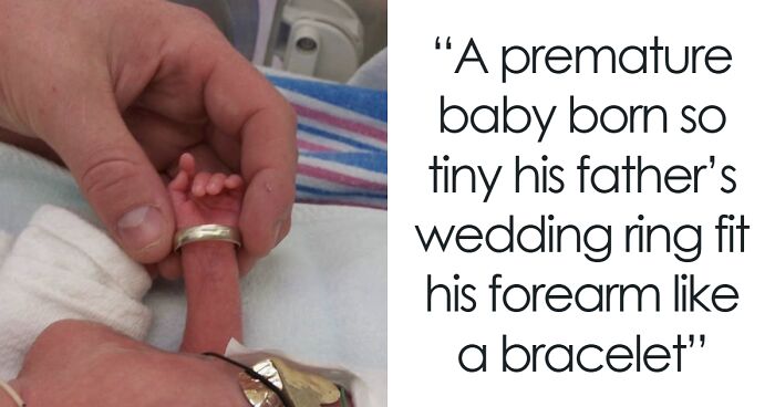 57 Fascinating And Unnerving Medical Pics You May Need A Minute To Process (New Pics)