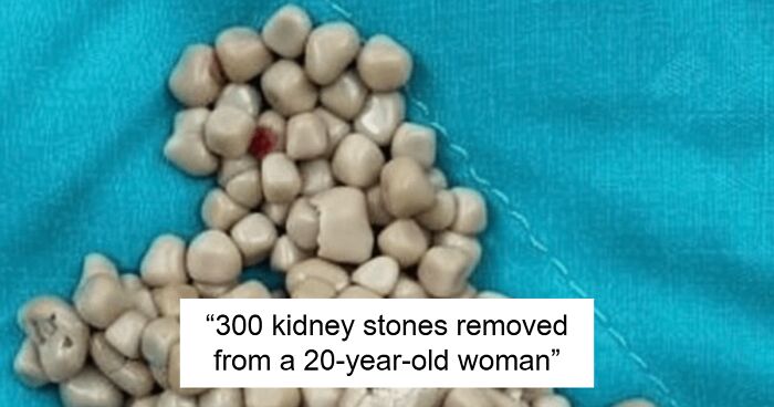 57 Fascinating And Unnerving Medical Pics You May Need A Minute To Process (New Pics)