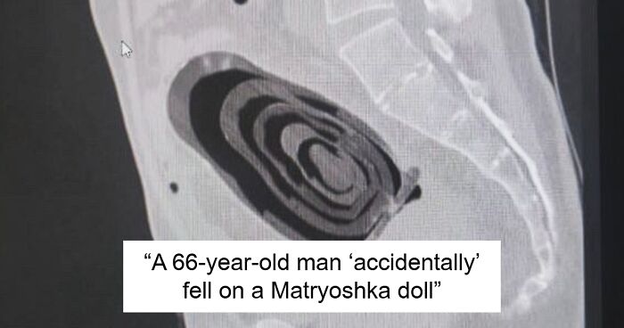 57 Fascinating And Unnerving Medical Pics You May Need A Minute To Process (New Pics)