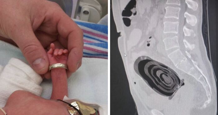 57 Fascinating And Unnerving Medical Pics You May Need A Minute To Process (New Pics)