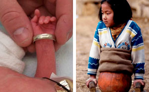 57 Fascinating And Unnerving Medical Photos Not Everyone Can Handle (New Pics)