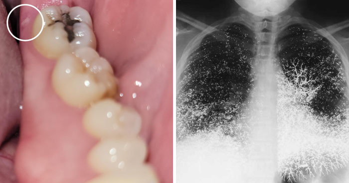 57 Fascinating And Unnerving Medical Photos Not Everyone Can Handle (New Pics)