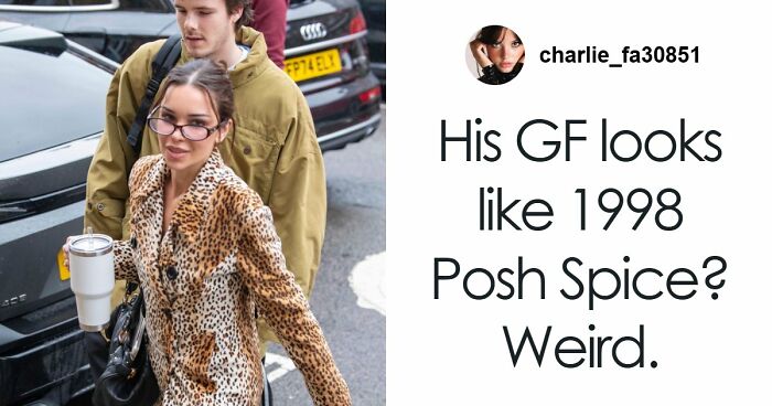 “It’s A Sight I’ll Never Forget”: 50 Unique Physical Features That Fascinated People