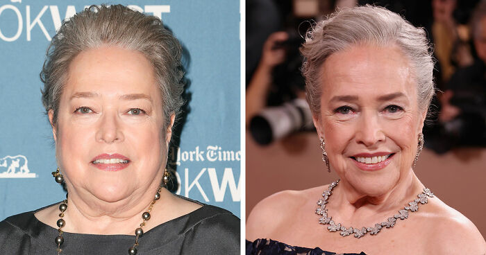 10 Stars Whose Dramatic Transformations Stunned Fans At The 2026 Golden Globes