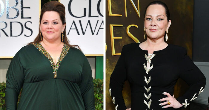 10 Stars Whose Dramatic Transformations Stunned Fans At The 2026 Golden Globes