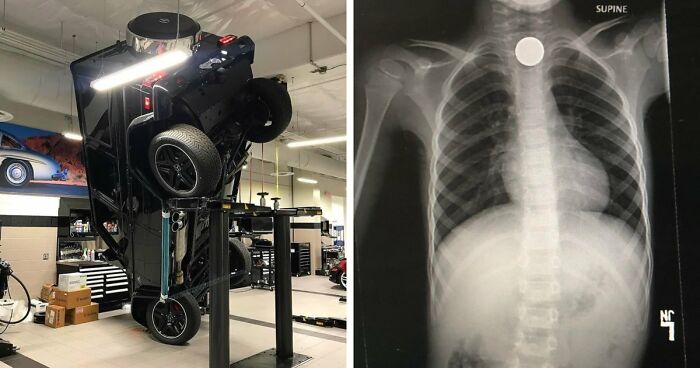 75 Times People Shared Painful Pics Of Their Expensive Blunders (New Pics)