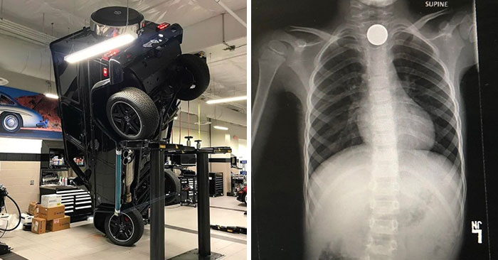 75 Expensive Mistakes People Made That Might Make You Say “Ouch” Just Looking At Them (New Pics)