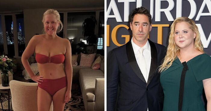 57 Fascinating And Unnerving Medical Photos Not Everyone Can Handle (New Pics)