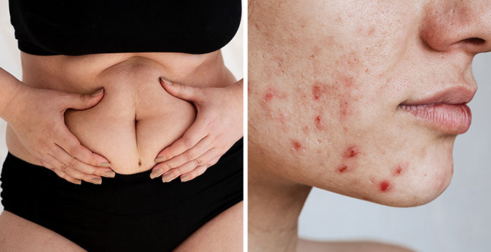 “It’s Not Studied Properly”: 70 Things Women Wish They Had Been Told About Their Bodies Earlier On