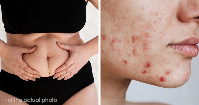 “I Seriously Thought Something Was Wrong With Me”: 70 Facts About Their Bodies Women Wish They Knew Sooner