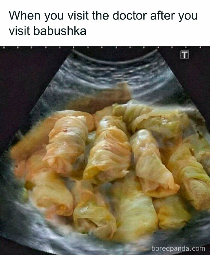 Ultrasound image humorously showing cabbage rolls inside a stomach, capturing the Eastern European experience in a funny way.