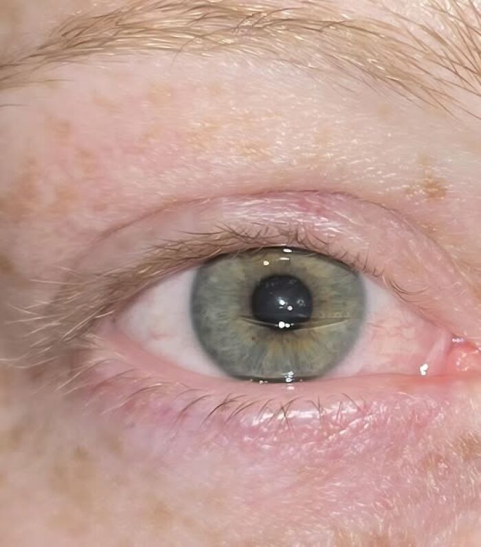 Close-up of a hazel green eye with dilated pupil and freckled skin, woke up photo