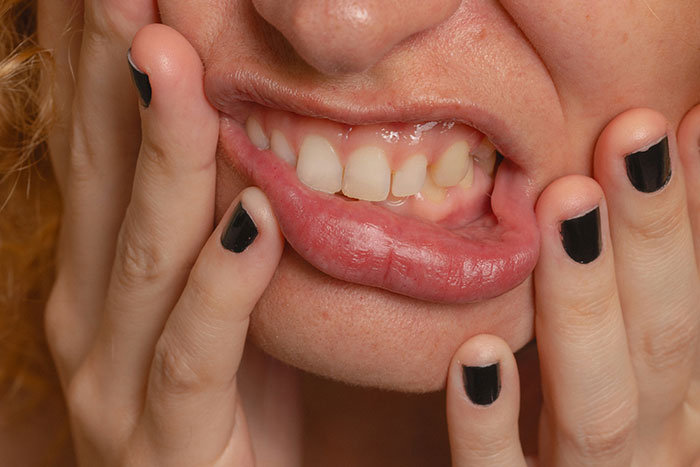 57 Things Women Did To Their Bodies As Teens Because Beauty Standards Said They Should