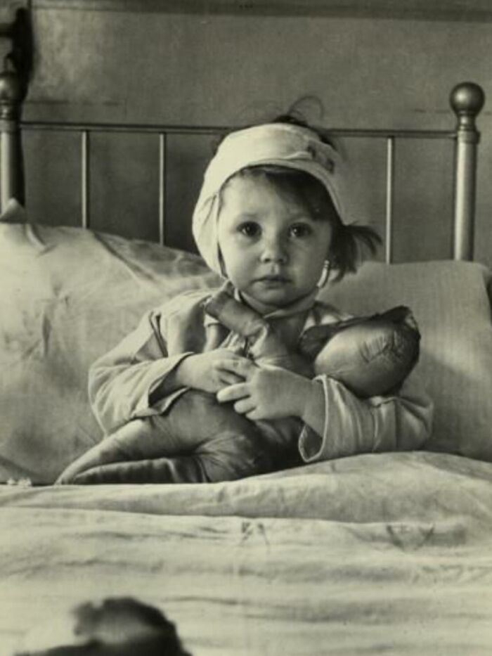 Young child in a hospital bed holding a doll, a poignant photograph reflecting the sad history of humanity.