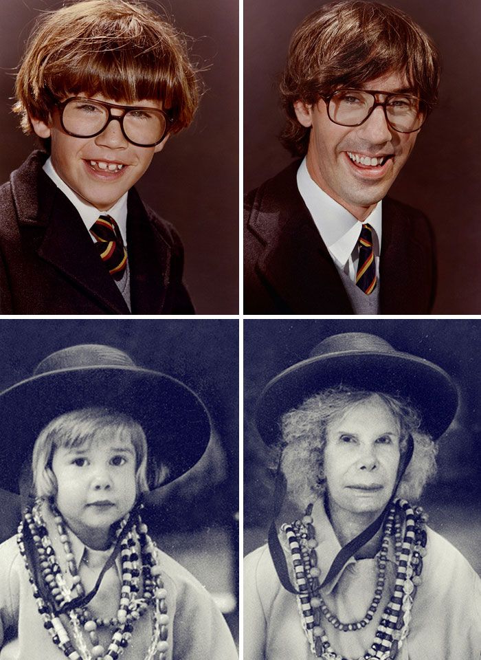 Dramatic before and after pics featuring childhood and adult portraits highlighting striking transformations over time.