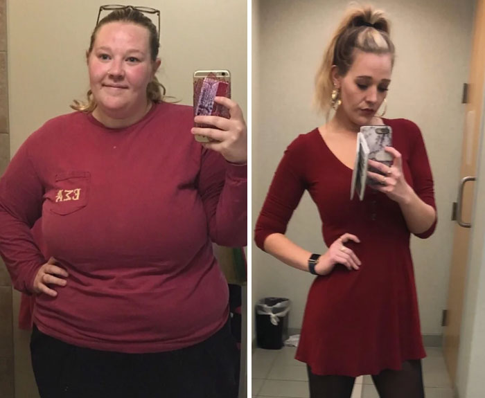 Before and after dramatic weight loss transformation of a woman, showcasing impressive body change and confidence boost.