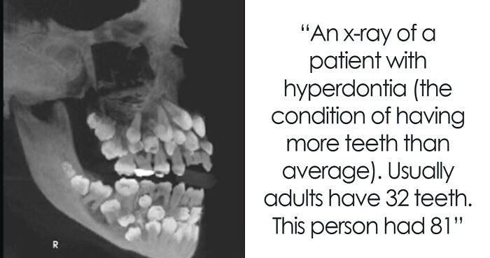 25 “Interesting But Creepy” Photos You Might Not Be Able To Look Away From (New Pics)