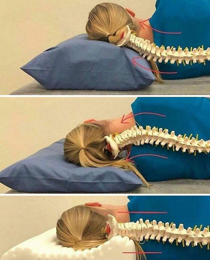 Comparison of three sleeping positions showing the spine alignment with pillows in unnerving medical pics.