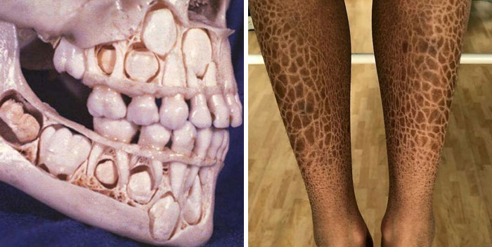 80 Fascinating And Unnerving Medical Pics You May Need A Moment To Process
