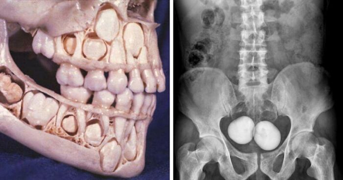 80 Medical Pics That Are Weirdly Mesmerizing And Slightly Disturbing