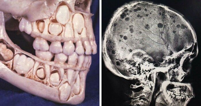 80 Medical Pics That Are Weirdly Mesmerizing And Slightly Disturbing