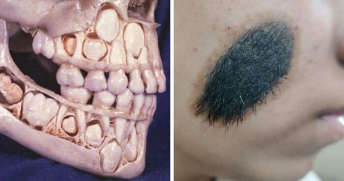 80 Medical Pics That Are Weirdly Mesmerizing And Slightly Disturbing