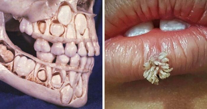 50 Medical Pics That Are Weirdly Mesmerizing And Slightly Disturbing