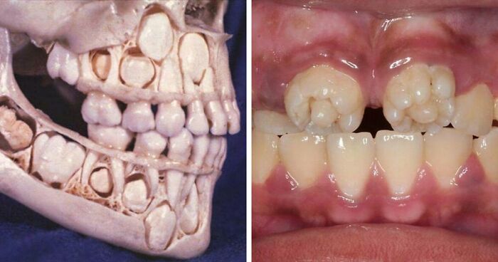 80 Medical Pics That Are Weirdly Mesmerizing And Slightly Disturbing