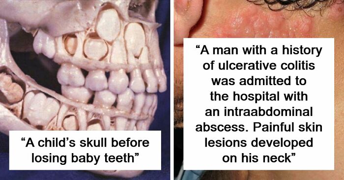 80 Medical Pics That Are Weirdly Mesmerizing And Slightly Disturbing