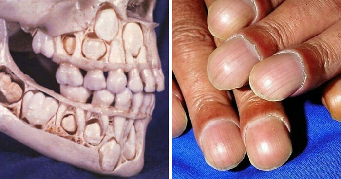80 Fascinating And Unnerving Medical Photos Not Everyone Can Handle