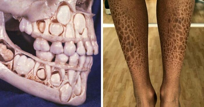 80 Fascinating And Unnerving Medical Photos Not Everyone Can Handle