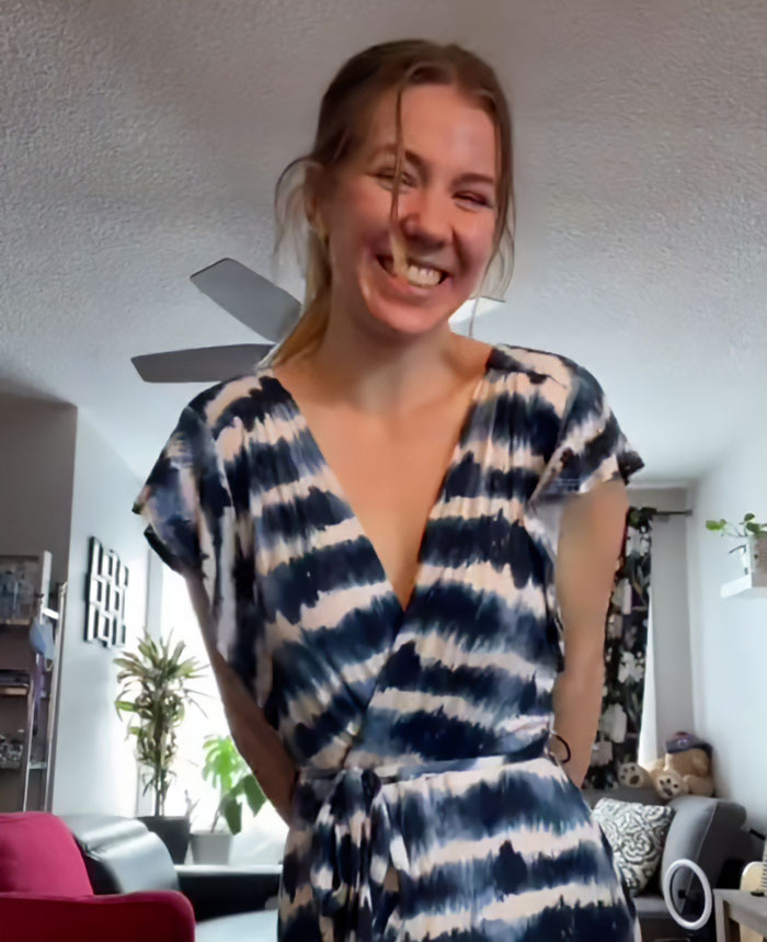 Smiling woman wearing a tie-dye dress standing in a living room after going viral for breast reduction.