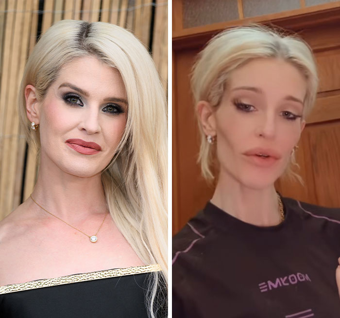 Kelly Osbourne in two side-by-side images showing her appearance change, fans urging her to seek help. Kelly Osbourne in two side-by-side images showing her appearance change, fans urging her to seek help.