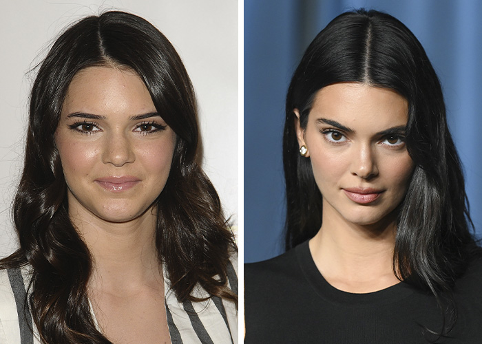 Internet Dragged Kendall Jenner After Her Claim That She’s Never Had Surgery Internet Dragged Kendall Jenner After Her Claim That She’s Never Had Surgery