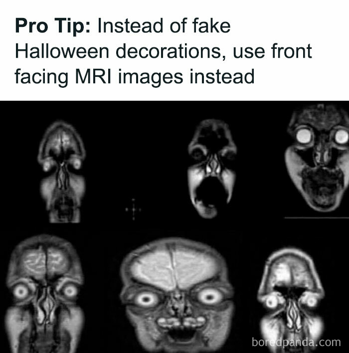 Humorous Halloween tip showing front facing MRI images as spooky decorations, blending humor and healthcare themes.
