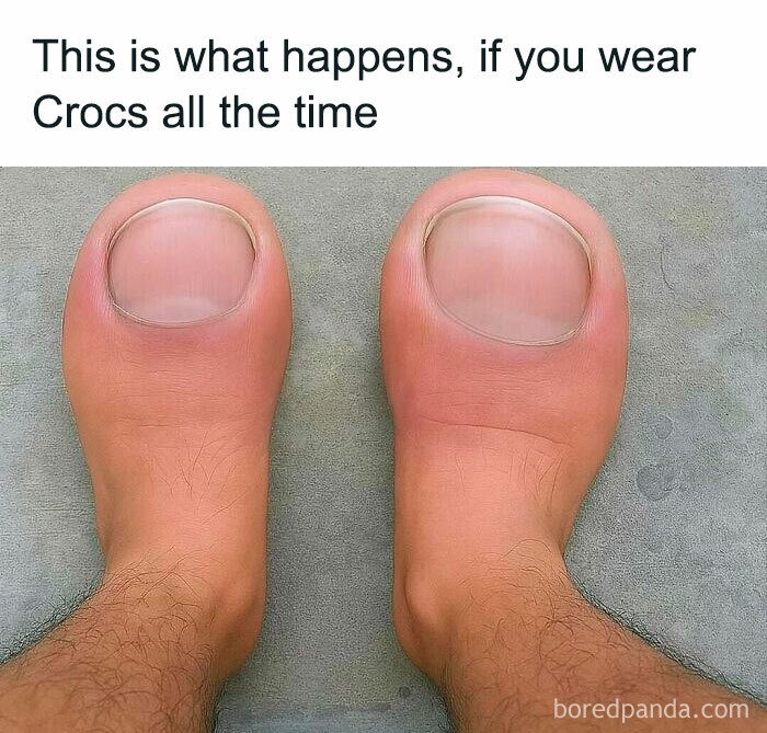 Humorous meme showing feet with nail heads, highlighting funny healthcare and expensive medical memes.