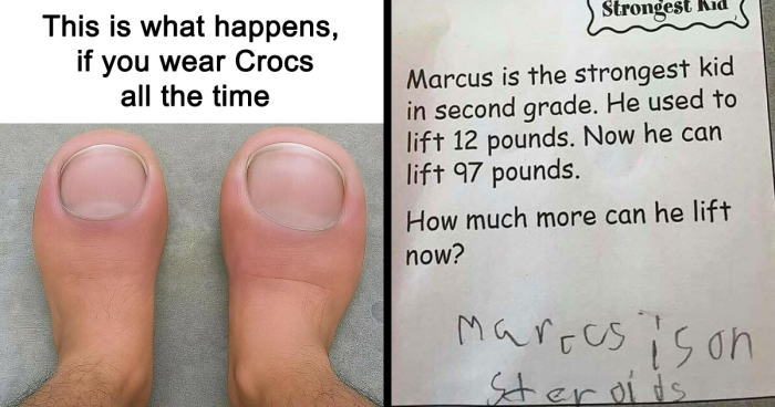 81 Memes To Read And Hope That Humor Really Is The Best Medicine Because Healthcare Is Expensive (New Pics)