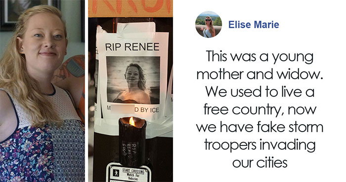 57 Fascinating And Unnerving Medical Photos Not Everyone Can Handle (New Pics)